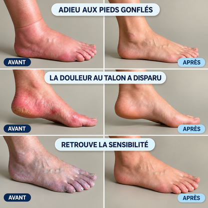ThermaPied™ – Masseur Pieds & Chevilles 3-en-1 Chauffant